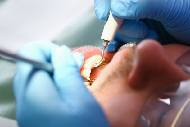 Best After-Hours Dental Trauma Care in Mills River, NC