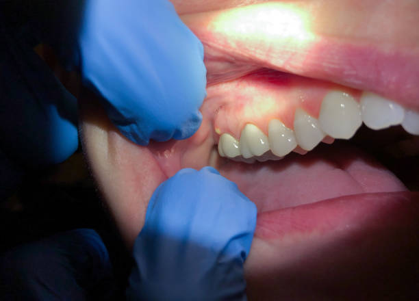 Best Same-Day Emergency Dental Services in Mills River, NC