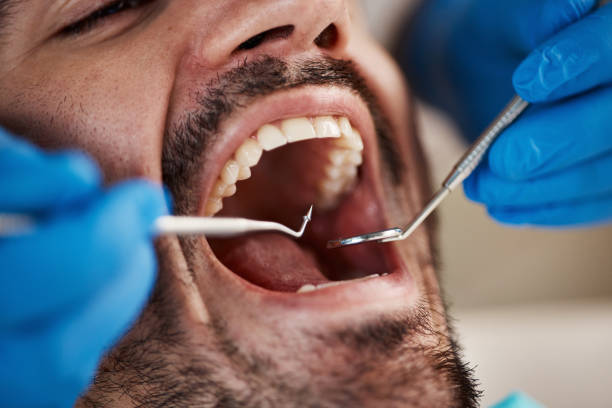 Best Emergency TMJ Treatment in Mills River, NC